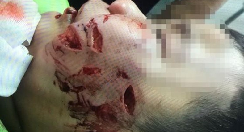 Tran Truong Thinh suffered serious injuries to his face after being bitten by the family's pet dog. 