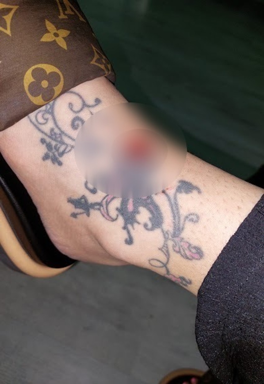 Jelena Radanović povrede