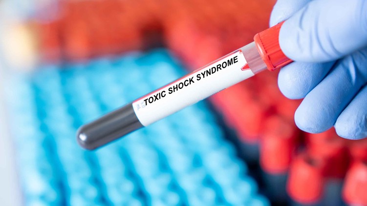 Toxikus sokk szindróma tünet vizsgálat kezelés