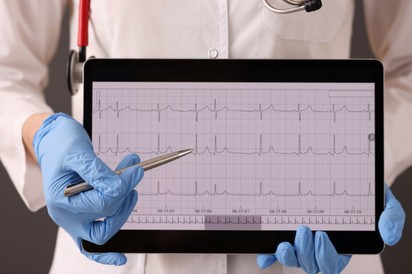 Tudta, hogy ez a szívprobléma stroke-hoz vezethet? Ismerje meg az 5 tünetét!