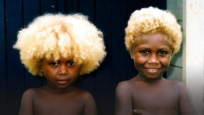 Melanesians Meet The World S Only Natural Black Blondes Pulse