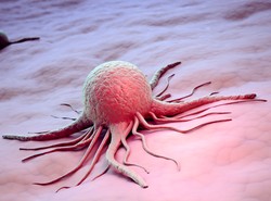 Złośliwy rak skóry nie odpuszcza Polakom. Lekarze alarmują