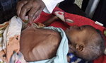 Pomóżmy dzieciom z Somalii! One cierpią