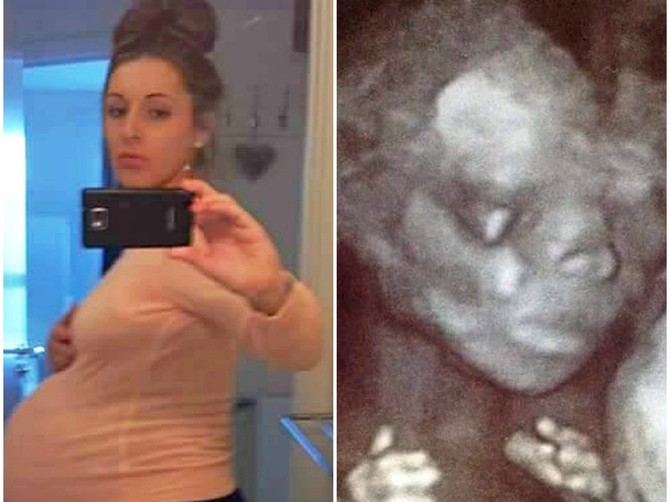 O njenoj neverovatnoj trudnoći pisali su svi mediji