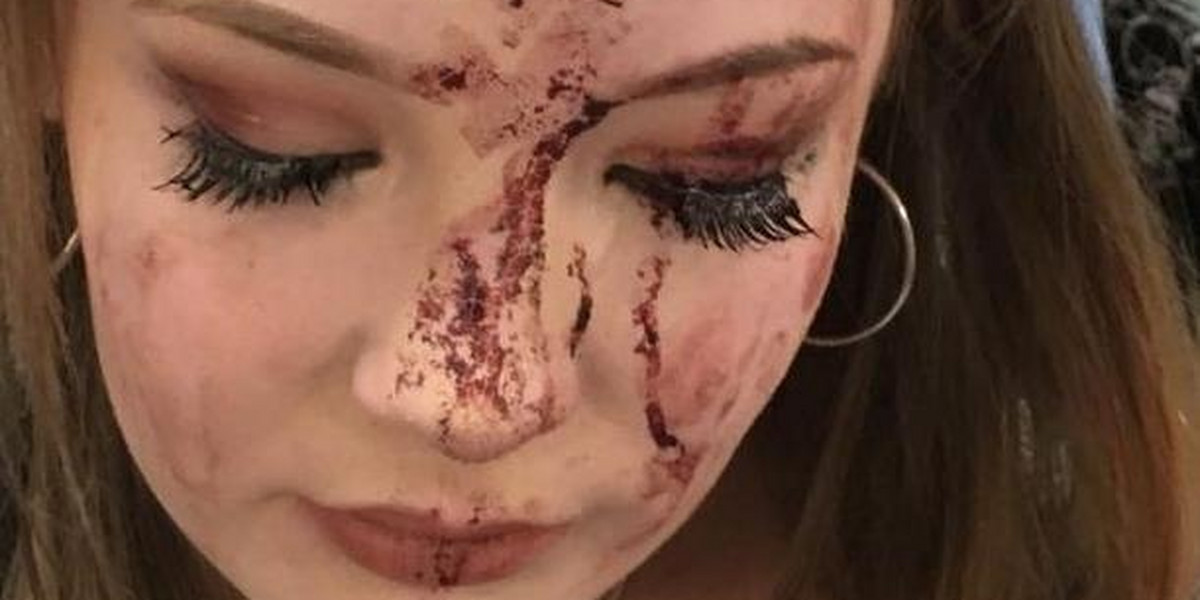 Koszmar na urodzinach! Nastolatka zalała się krwią