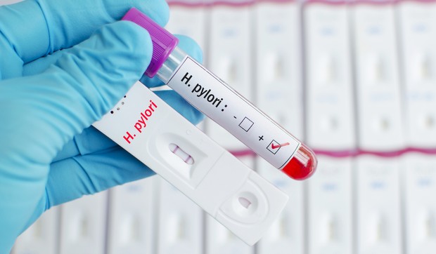Test krvi na helikobakteriju nije najpouzdaniji