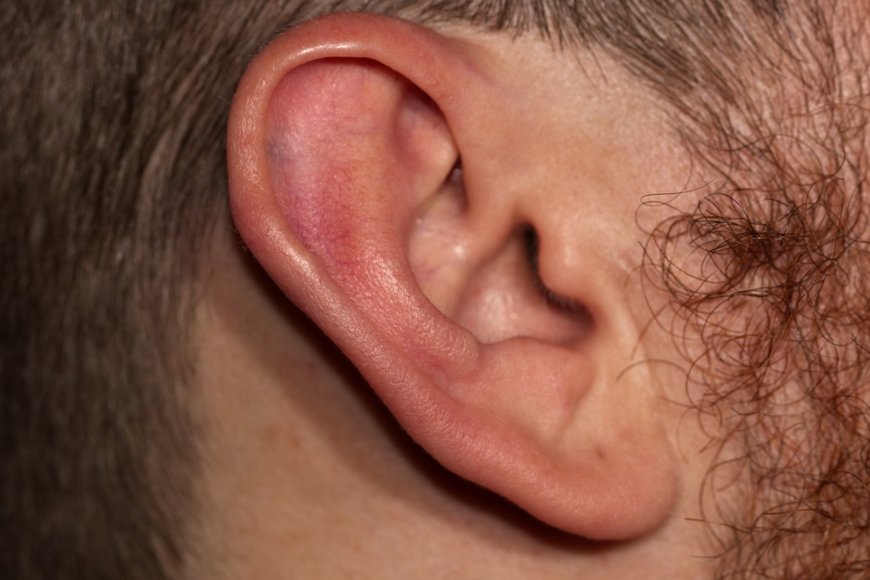 Frankov znak sa objavuje na ušných lalôčikoch. (ilustračné foto)