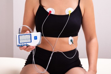 holter, ekg, szívritmuszavar, szívbetegség