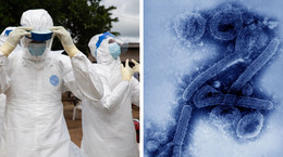 Wirus Marburg - skrajnie niebezpieczny wirus w Afryce