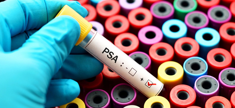 Badanie PSA w kierunku raka prostaty warto wykonywać już od 40. roku życia