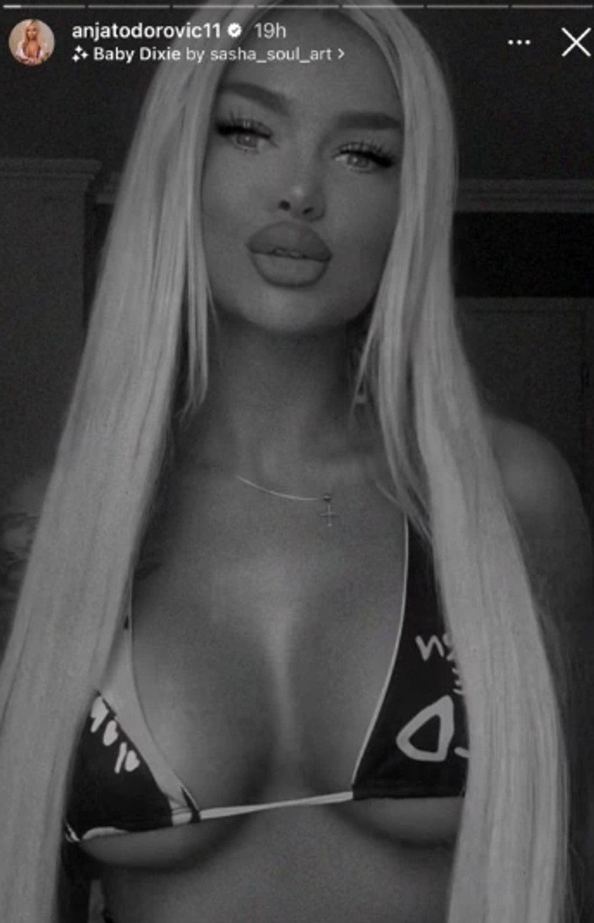 Anja Todorović pokazala silikone