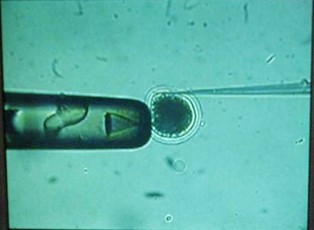 Skutki uboczne nowej ustawy o in vitro. Ruszyła wielka emigracja zarodków