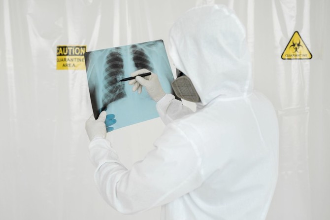 Poređenja KOVID- 19  sa SARS-om i MERS-om