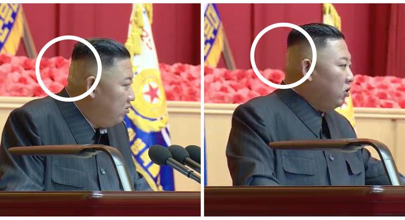 A July 30 report on Korea Central Television shows Kim Jong Un with the band aid on the back of his head.
