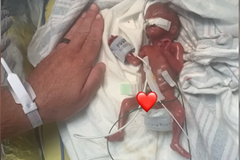 Kada se rodio, nije bio veći od OČEVOG DLANA i bio je lakši od TABLE ČOKOLADE: Lekari mu nisu davali nikakve šanse da će PREŽIVETI, a danas je u GINISOVOJ KNJIZI REKORDA