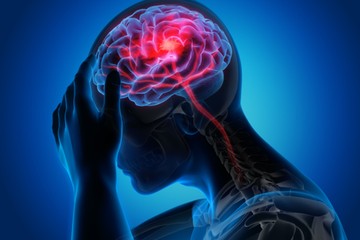 stroke típusai tévhitek tünetek megelőzés idősek