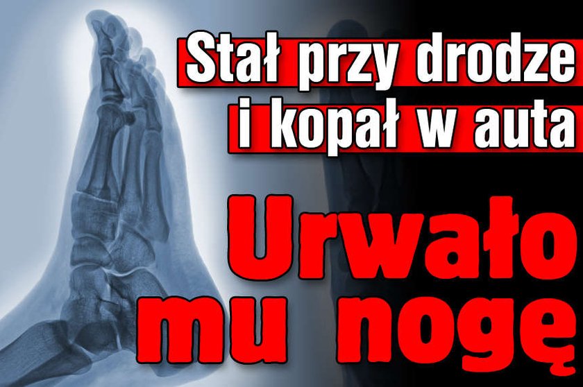 Stał przy drodze i kopał w auta. Urwało mu nogę