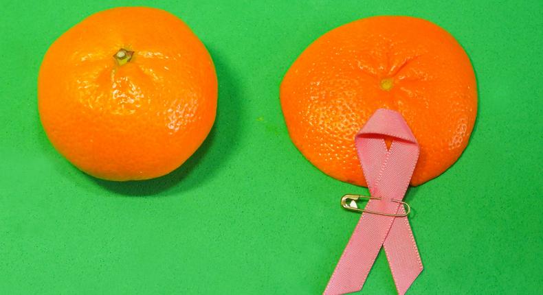 Cancer du sein : les femmes dont le test est positif pour certaines mutations génétiques ou qui ont des antécédents familiaux de cancer du sein peuvent choisir de subir une mastectomie prophylactique. Japatino / Getty Images