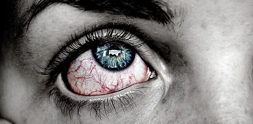 Po przebudzeniu bolą cię oczy? Nie ignoruj tych objawów!