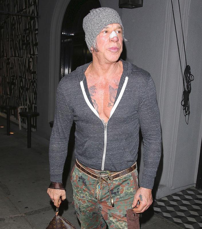 mickey rourke fogyás