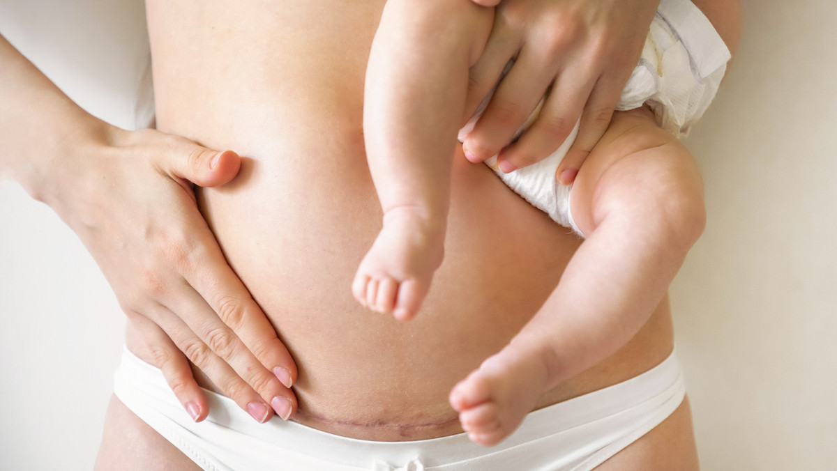 Brzuch po porodzie: jak wygląda, w jaki sposób się zmienia i kiedy myśleć o korekcie?