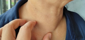 pajzsmirigy betegség kezelés hormon gyógyszer műtét