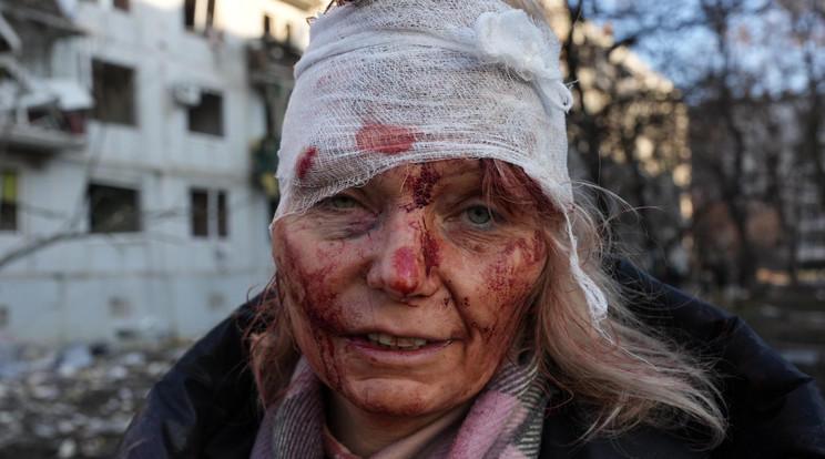 Egy sebesült nő, akit Olena Kuriloként , miután 2022. február 24-én légicsapást mértek egy lakóparkba az ukrajnai Harkiv mellett / Fotó: Getty Images