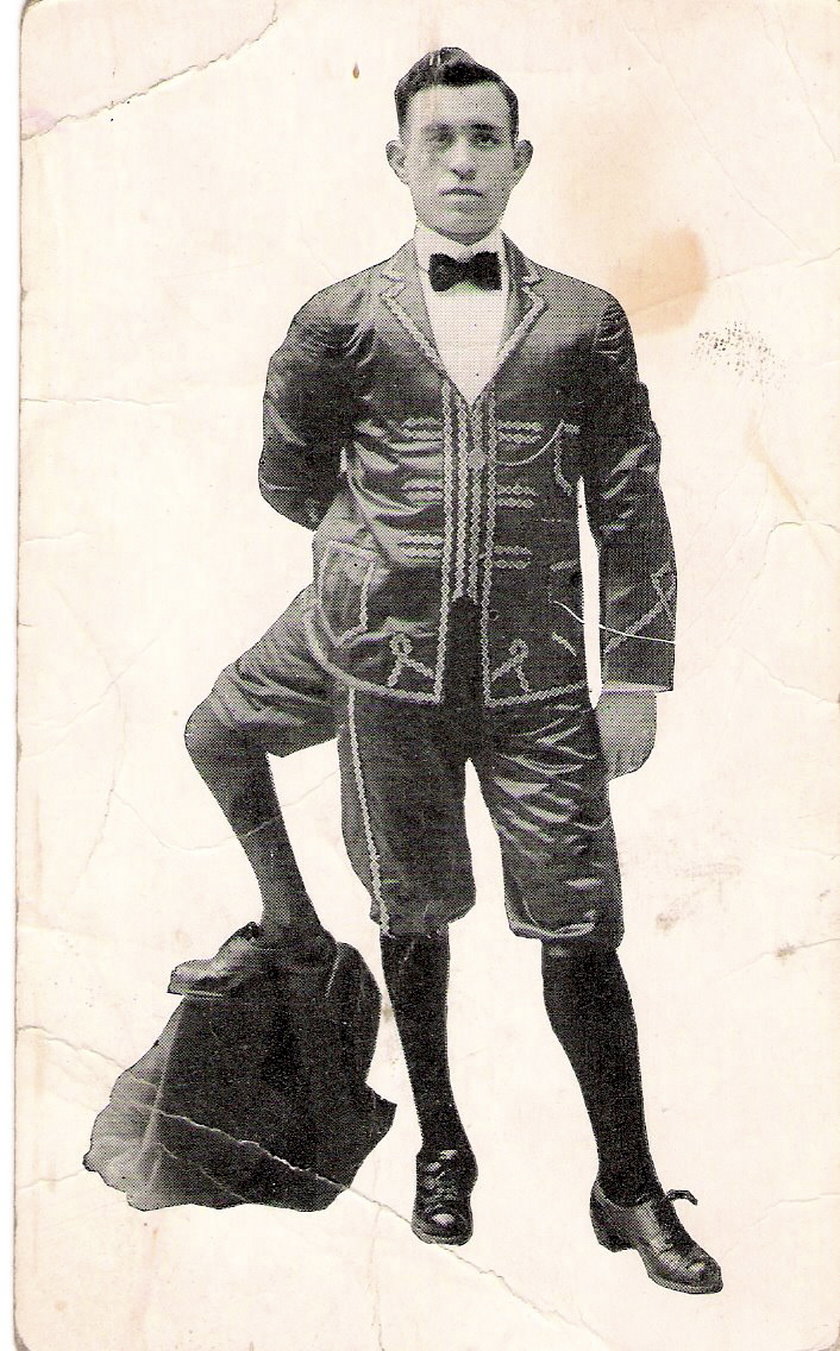 Видит три ноги. Франческо Лентини. Франческо (Фрэнк) Лентини. Франческо Лентини человек с тремя ногами. Франческо Лентини (1881-1966).