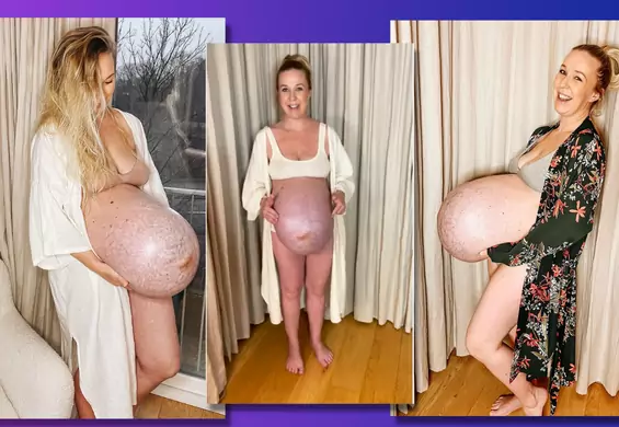 Mama trojaczków pokazała ciążowy brzuch w 35. tygodniu. Internauci zaniemówili