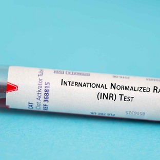 Mit jelent az INR érték a laborleleten?