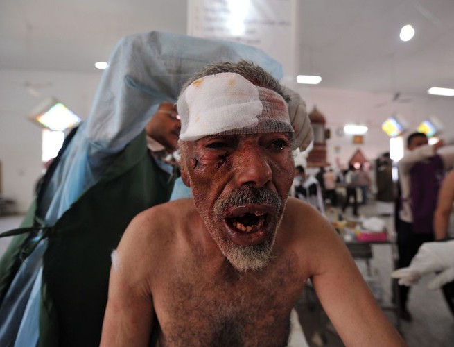 Mężczyzna ranny w czasie zamieszek w Sanie, przeciwko prezydentowi Jemenu Alemu Abdullahowi Salehowi, październik 2011