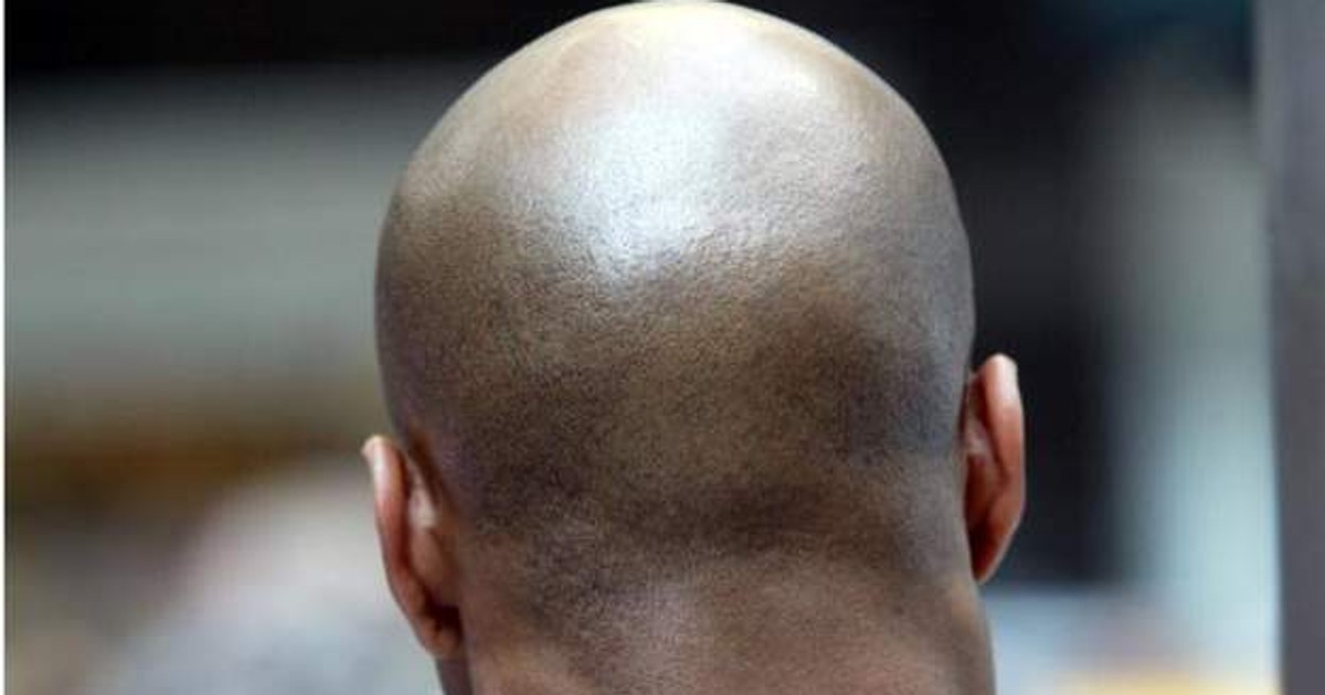 New study shows energy drinks may lead to baldness in men Pulse Uganda