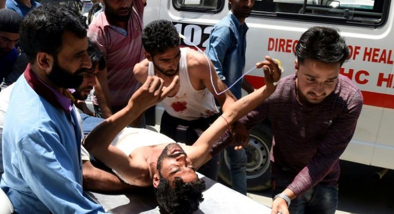 Kashmiri villagers bring a resident injured by Indian security personnel to the main hospital in Srinagar on July 3, 2017