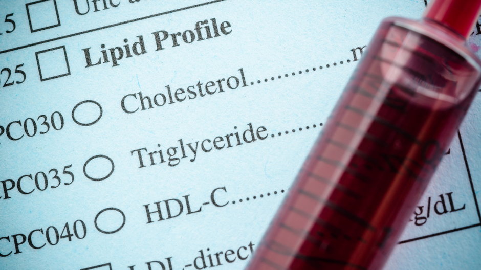 Wysoki cholesterol może być przyczyną wielu chorób - gamjai/stock.adobe.com