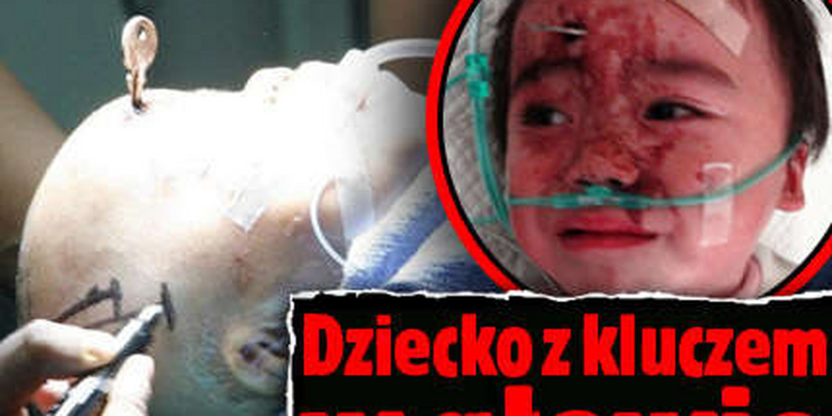 Dziecko z kluczem w głowie