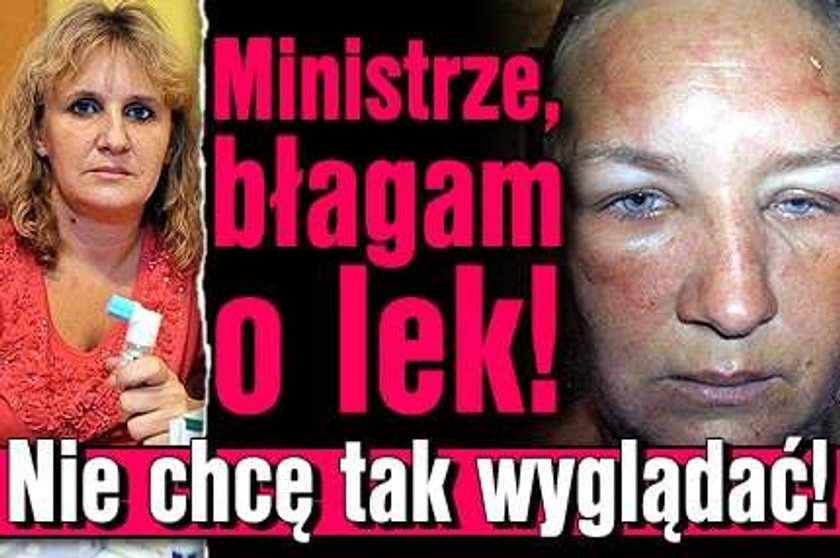 Ministrze, błagam o lek! Nie chcę tak wyglądać!