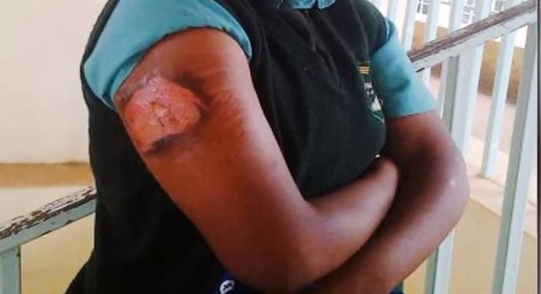 File image of a viral photo of a student nursing injuries Evans Bosire believes that the photo could be of his daughter at Nyanururu girls school