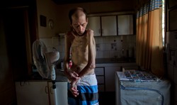 Zdeformowane dzieci, schorowani dorośli. Wstrząsający fotoreportaż z Argentyny. ZDJĘCIA