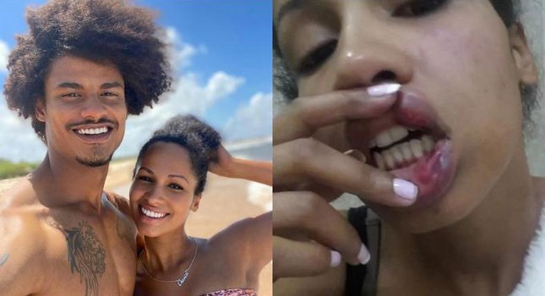 Nicola surrenders to the police over assaulting Eric Omondi's ex Chantal Grazioli