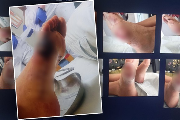 UHAPŠEN DOKTOR I KOZMETIČARKA ORDINACIJE IZ BEOGRADA Pogrešno lečio stopalo kod pacijenta (FOTO)