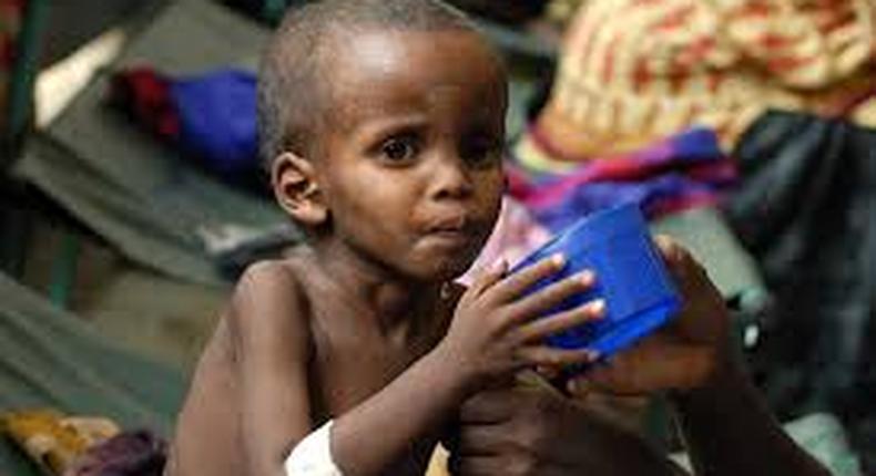 The study led by the African Union and backed by U.N. aid agencies and the African Development Bank noted consequences of stunting (low height for age) are of particular concern. 