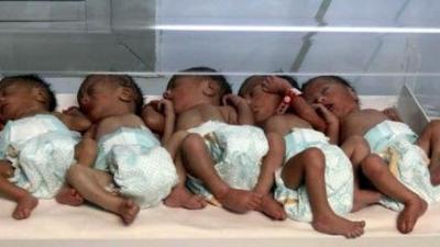 Anambra woman delivers quintuplets after 9 years of marriage, begs for help. (Photo used for the purpose of illustration)