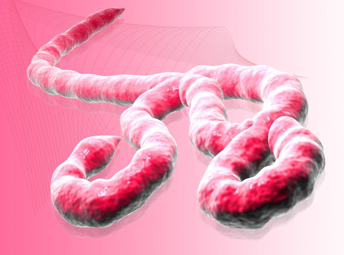 Czy Polakom zagraża wirus Ebola?