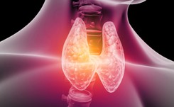 Wyprzedza czerniaka. RAK TARCZYCY atakuje coraz więcej osób. OBJAWY