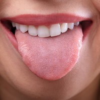 Lerakódás, dudor, elszíneződés a nyelven: ezeket a betegségeket jelzik!