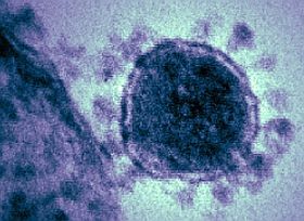 koronavirus-d000016188fb0f0eb9bed