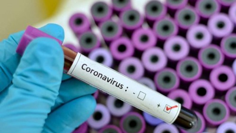 coronavirus blood specimen (GETTY Images)