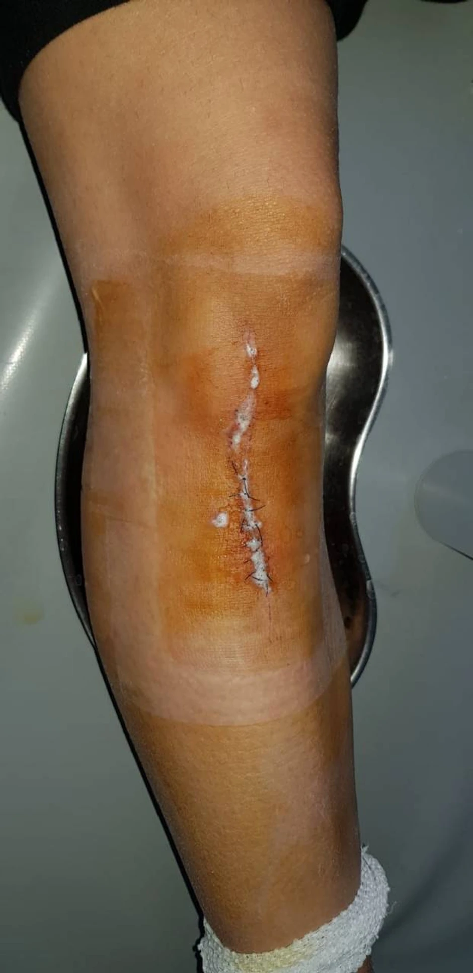 Devojčica je zaradila osam kopči