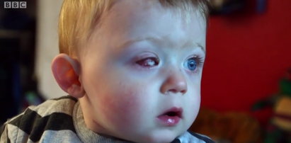 1,5 roczny Oskar stracił oko. Ojciec w szoku