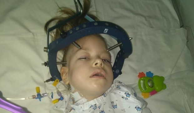 Mia Žikić posle teške operacije kojom su joj uklonjeni implanti 